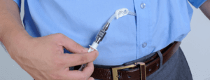 Peritoneal-Dialysis-Complications-and-Management