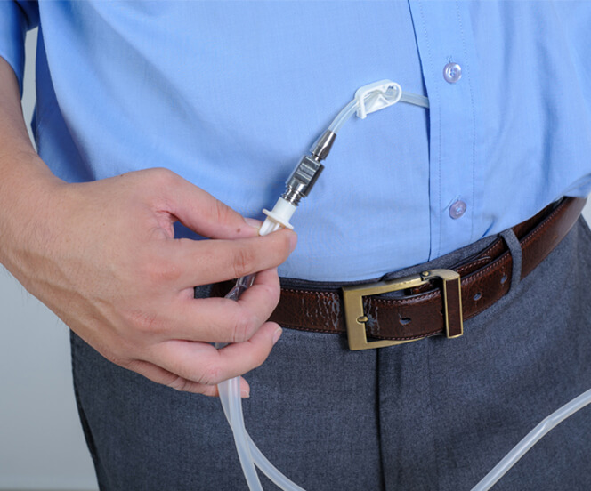 Peritoneal Dialysis